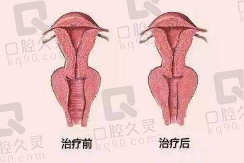 南宁华美整形美容医院厉害的项目是——皮肤美容