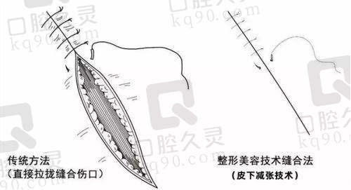 大连沙医生整形价格表揭秘，含眼部、鼻部、面部轮廓整形合理收费详情 