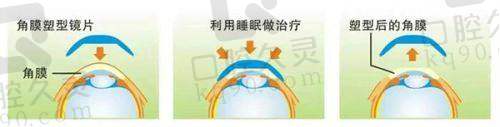 影响青岛华厦眼科医院儿童近视价格的因素