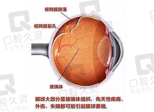 青岛华厦眼科医院儿童近视多少价位？验光39元起角膜塑形镜6100 - 9100元 