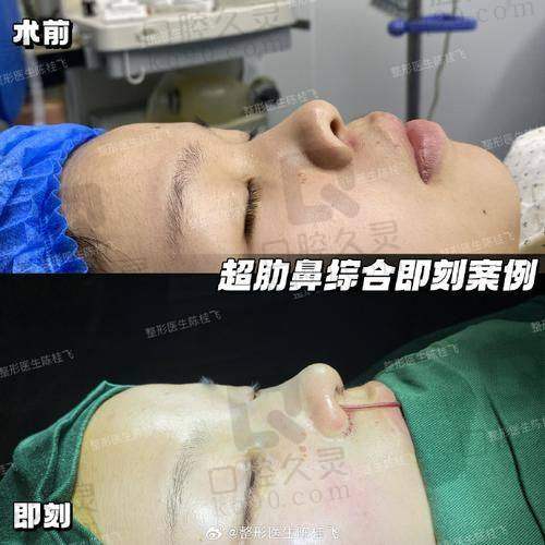 术后修复情况如何？
