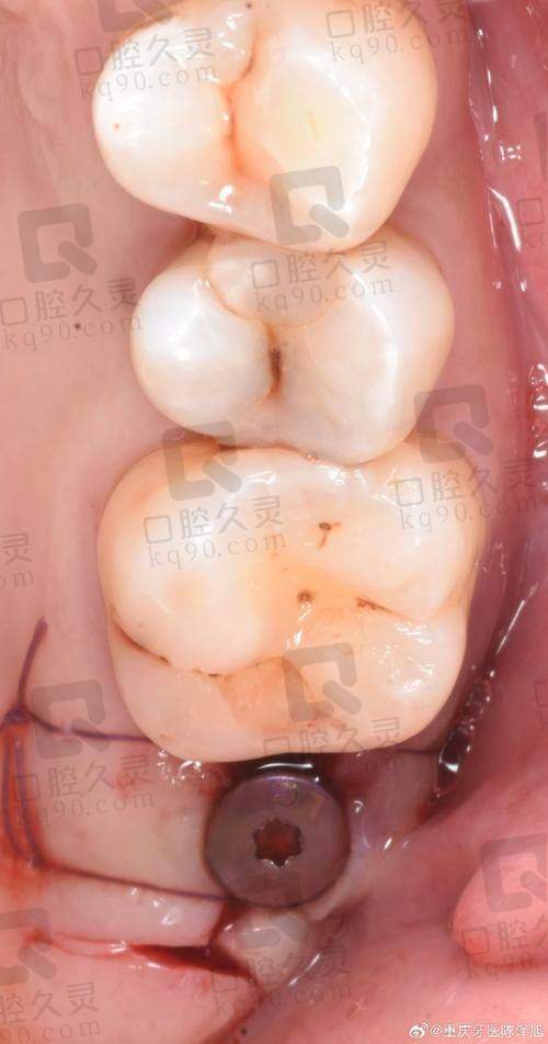 为什么选择雅安优诺口腔医院？