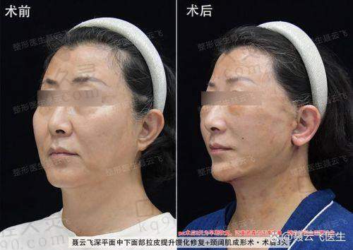 面诊时医生是如何评估我的面部情况的？