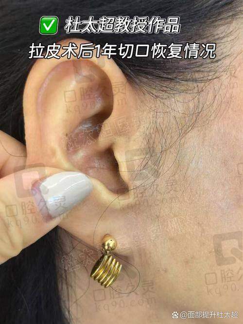 初到广州壹加壹医院，第一印象如何？