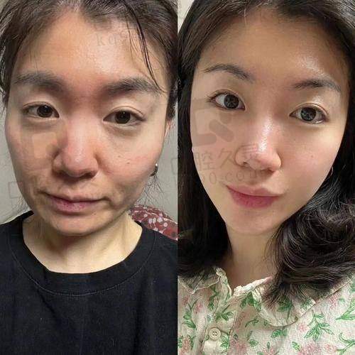 四、范惟医生——北京加减美的稳定之选