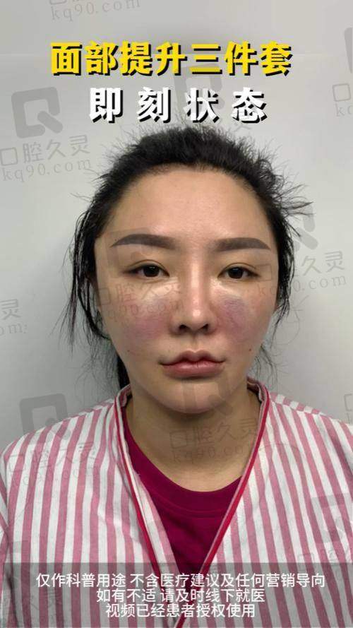 三、穆宝安医生——北京加减美的V美减龄大师