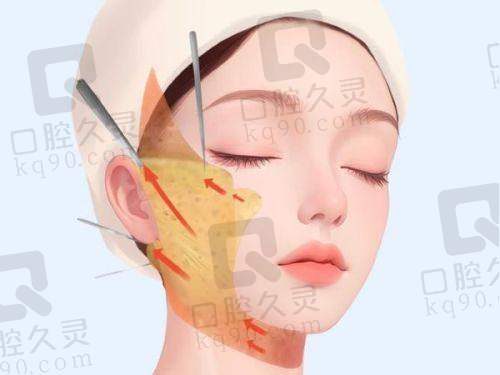 刘中策医生的擅长项目介绍