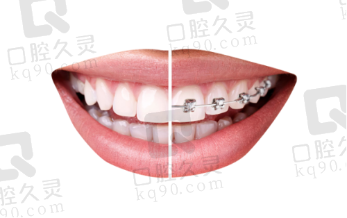 ?价格对比:2026口腔项目全景价格表(贞丰县人民医院口腔科)