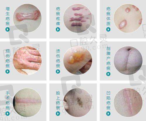 六、苏州美君医疗美容门诊部价格表:(仅供参考)