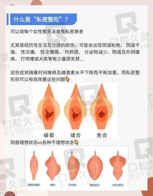 私密唇形的多样性