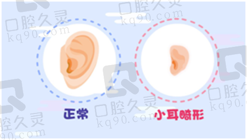郭树忠耳再造失败修复案例全曝光:仿生耳雕刻术,打造逼真自然的完美耳朵!