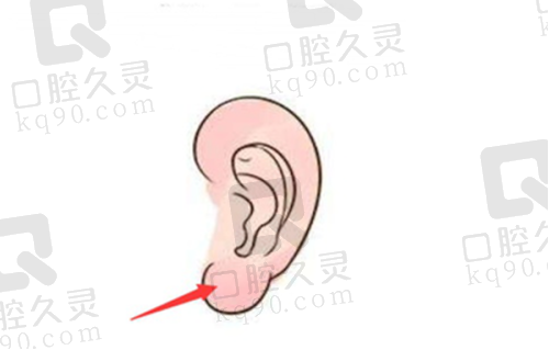 吸脂项目价格及特点