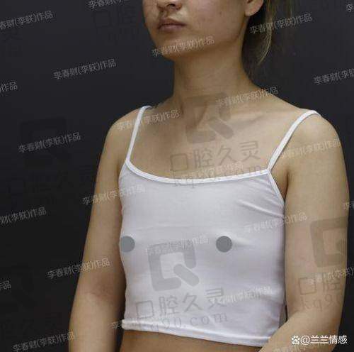 杭州维多利亚医疗美容医院刘中策的手术案例：自体脂肪、假体隆胸等多手术案例见证精湛医美技艺 