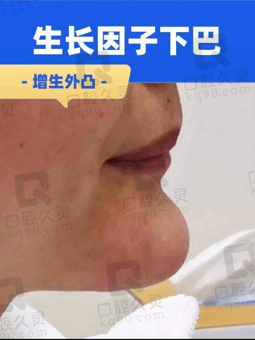 朱庆武医生擅长项目与生长因子处理