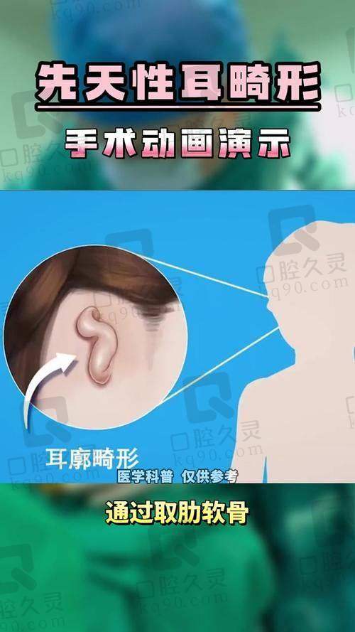 耳再造手术费用与注意事项：郭树忠团队术式透明，服务细致