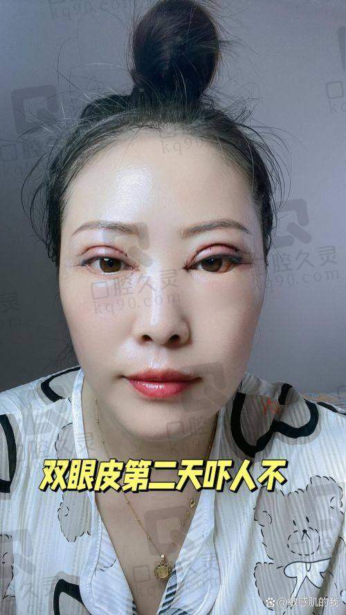 专精能力剖析：罗文婷的技术属于哪种档次？
