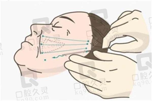 昆明市做面部轮廓好的医院有哪些？梦想、艺星、吴氏嘉美等实力初中