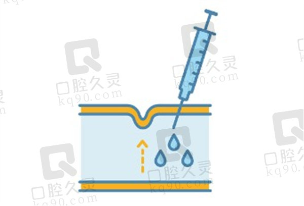 昆明韩辰整形美容医院溶解酶案例分享：玻尿酸注射过量肿胀，溶解酶出手轻松化解难题 
