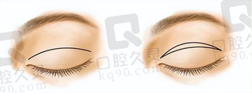青岛博士医疗美容医院有没有失败案例?正规资质多保障顾客好评多失败概率小