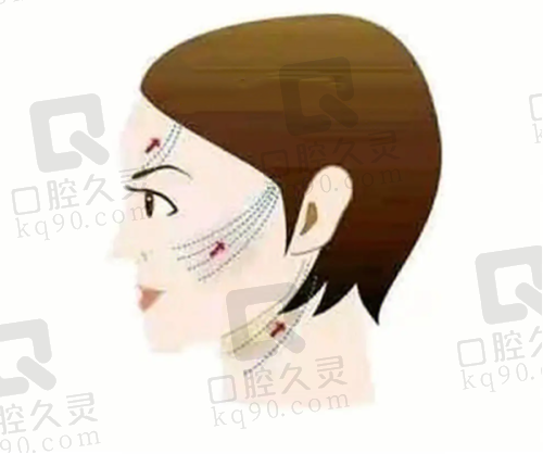北京画美医疗美容医院金圣基的号怎么挂——现场预约方式