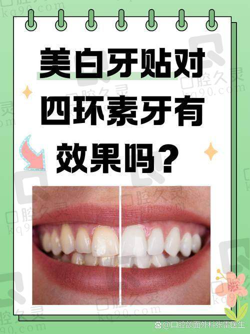 如何了解贵港蓝天口腔医院四环素牙的正确价格？