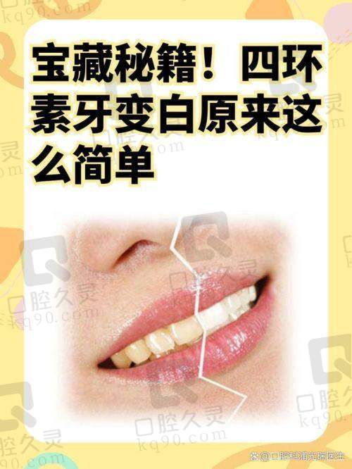 贵港蓝天口腔医院四环素牙治疗性价比高吗？