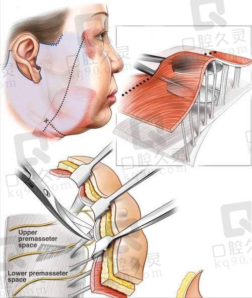 患者真实反馈怎么看谢洋春医生？