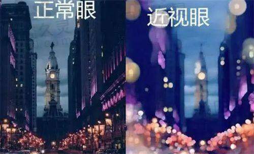 上海柠盟眼科门诊部是不是私人医院？正规审批、服务贴心，近视手术8K元起口碑好 