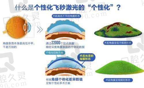 上海新视界眼科医院:强大的医生团队