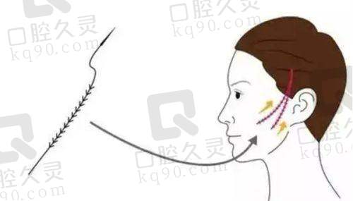 韩国注射乔雅登玻尿酸的十大皮肤科推荐:ECLATDE、Shinebom、Reyou、Doctors、GD等热门医院全解析