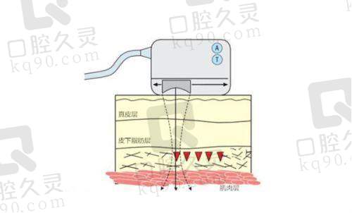 苏州圣爱整形医院口碑好吗?精良设备和专精团队是保护