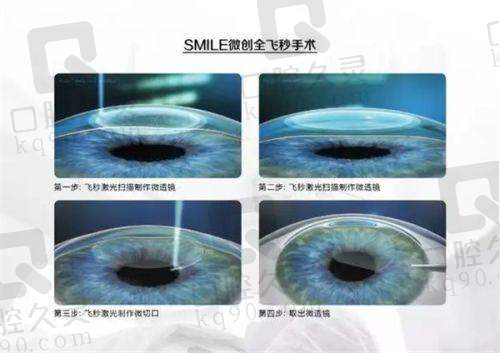 上海柠盟眼科2025收费标准查询来袭！近视、眼病、角膜塑形镜费用全在这儿