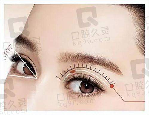 上海时光整形医院眼综合整形体验，重塑明亮双眸，恢复快效果自然超满意 