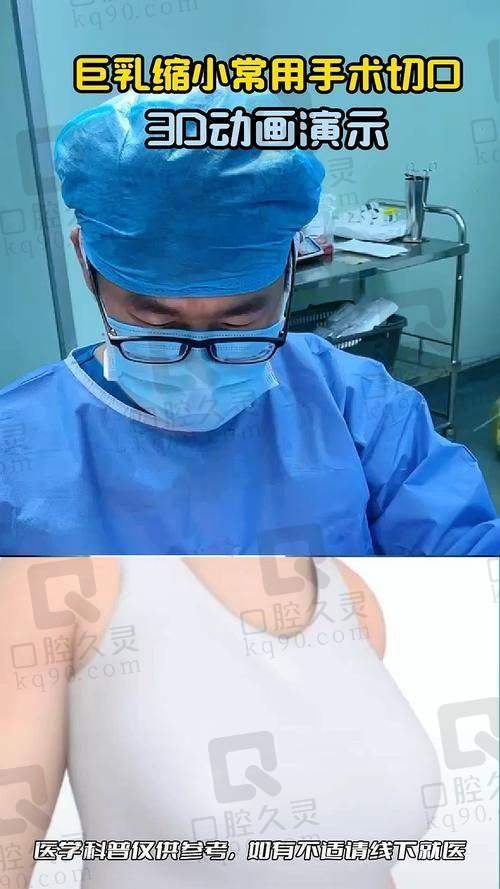 广州齐云香做缩胸手术怎么样？技术精湛经验丰富，个性化方案打造自然美胸 