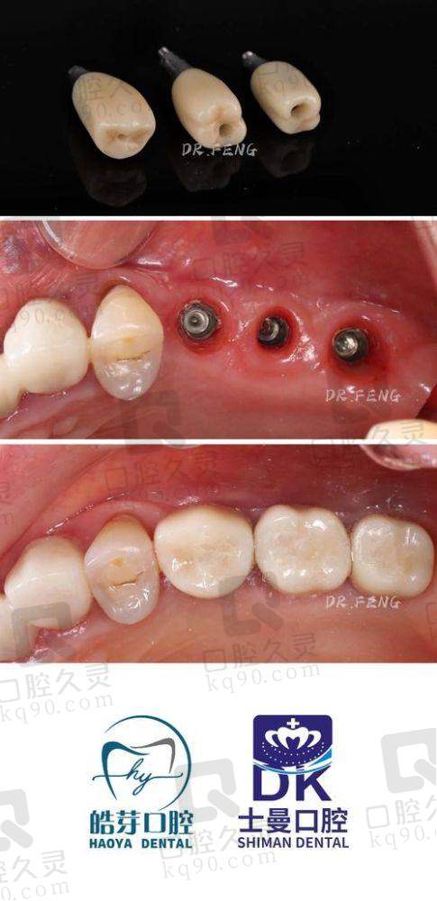 牙博士口腔矫正治疗口碑如何?