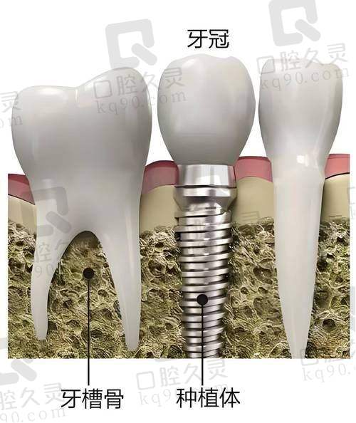 2. 牙博士口腔医院牙齿矫正价格表