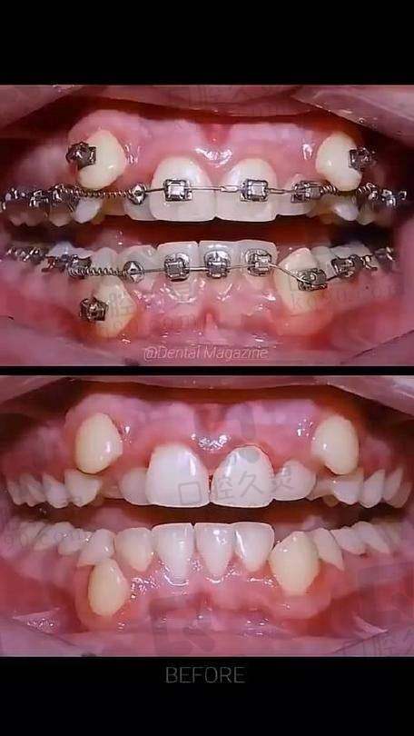 矫正成效怎么样？