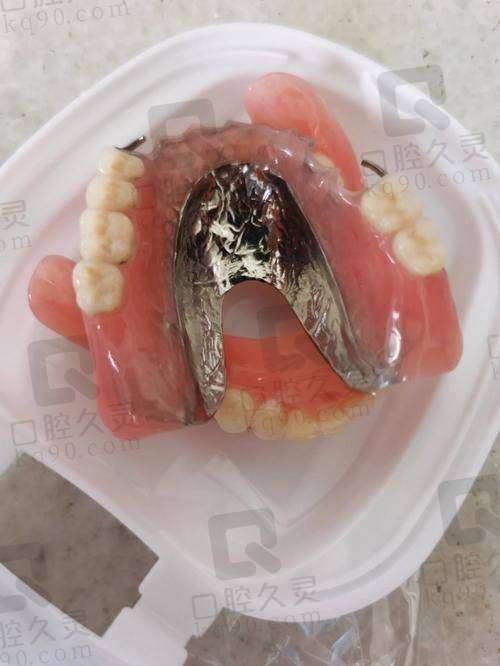 详细的检查与方案制定