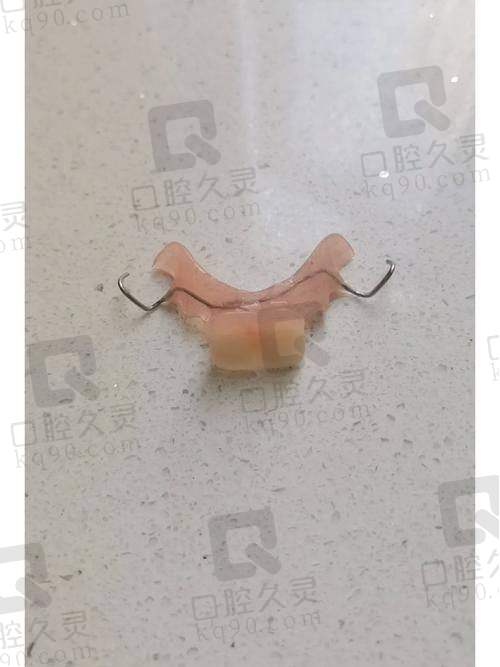 吸附性义齿的维护与注意事项