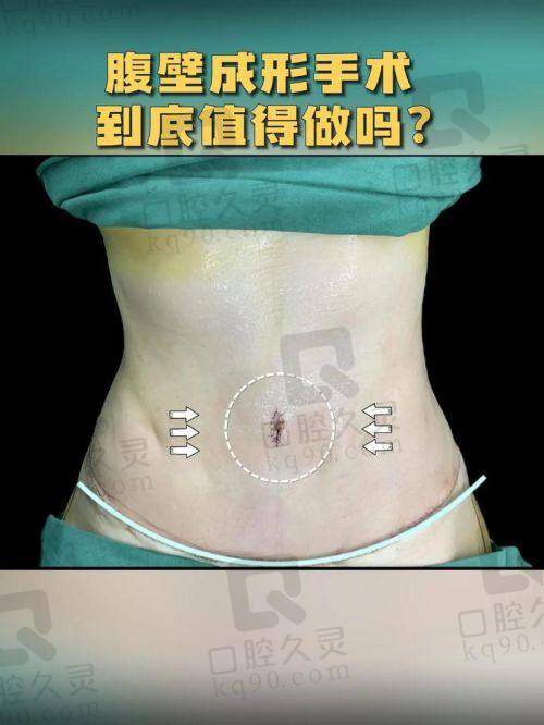 西安崔鑫怎么预约？