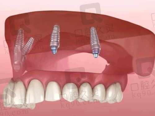 询问电话预约挂号流程