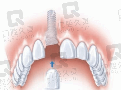 深圳愛康健口腔醫院(羅湖火車站店)