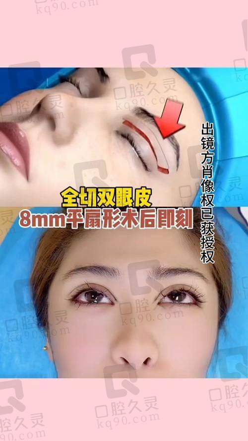 成都高亮怎么预约？