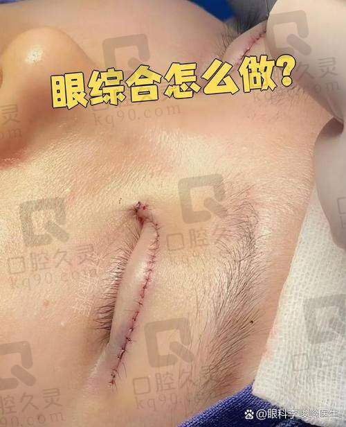 昆明韩辰整形美容医院切开双眼皮收费贵吗？费用明细大公开