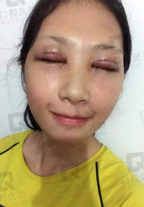 昆明韩辰整形美容医院医生技术如何？我的面诊体验