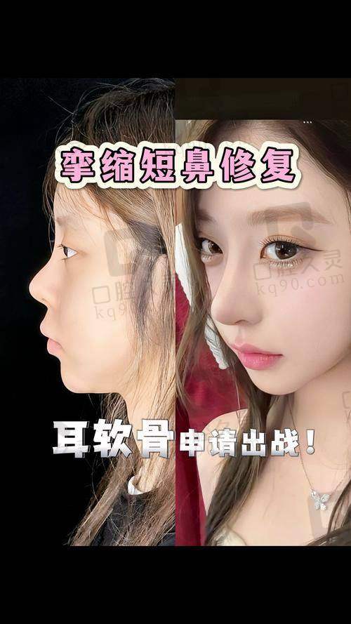 术后注意事项+挂号雷区预警，让你不踩坑