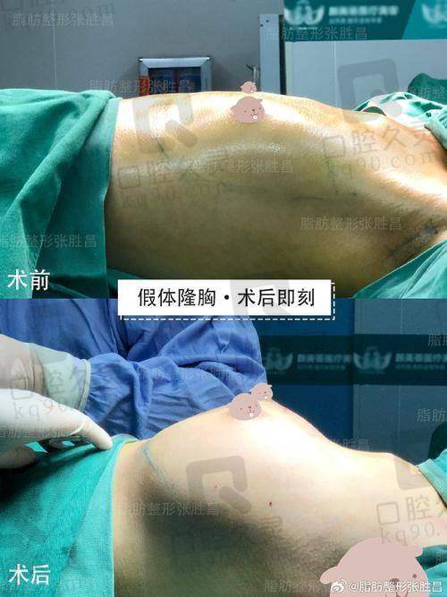医院口碑对医生性价比的影响