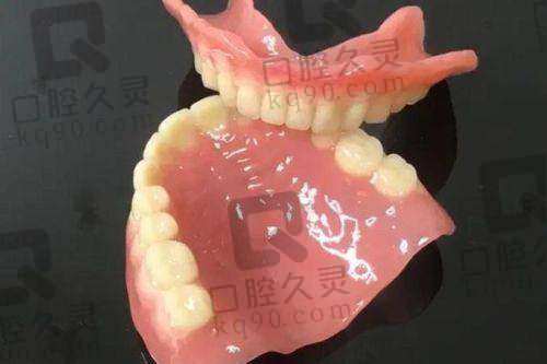 体验西宁诺贝尔口腔医院全口假牙，舒适贴合宛如真牙，重享美食咀嚼快乐！ 