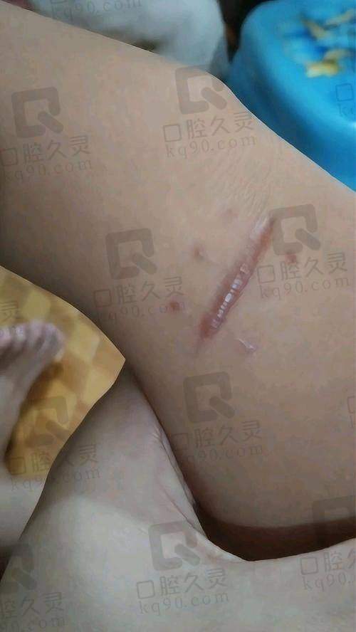 总结