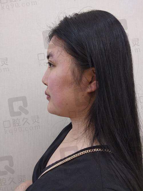 号源怎么这么难？掌握这些放号节奏，让你快人一步